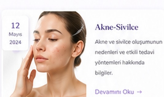 Akne-Sivilce